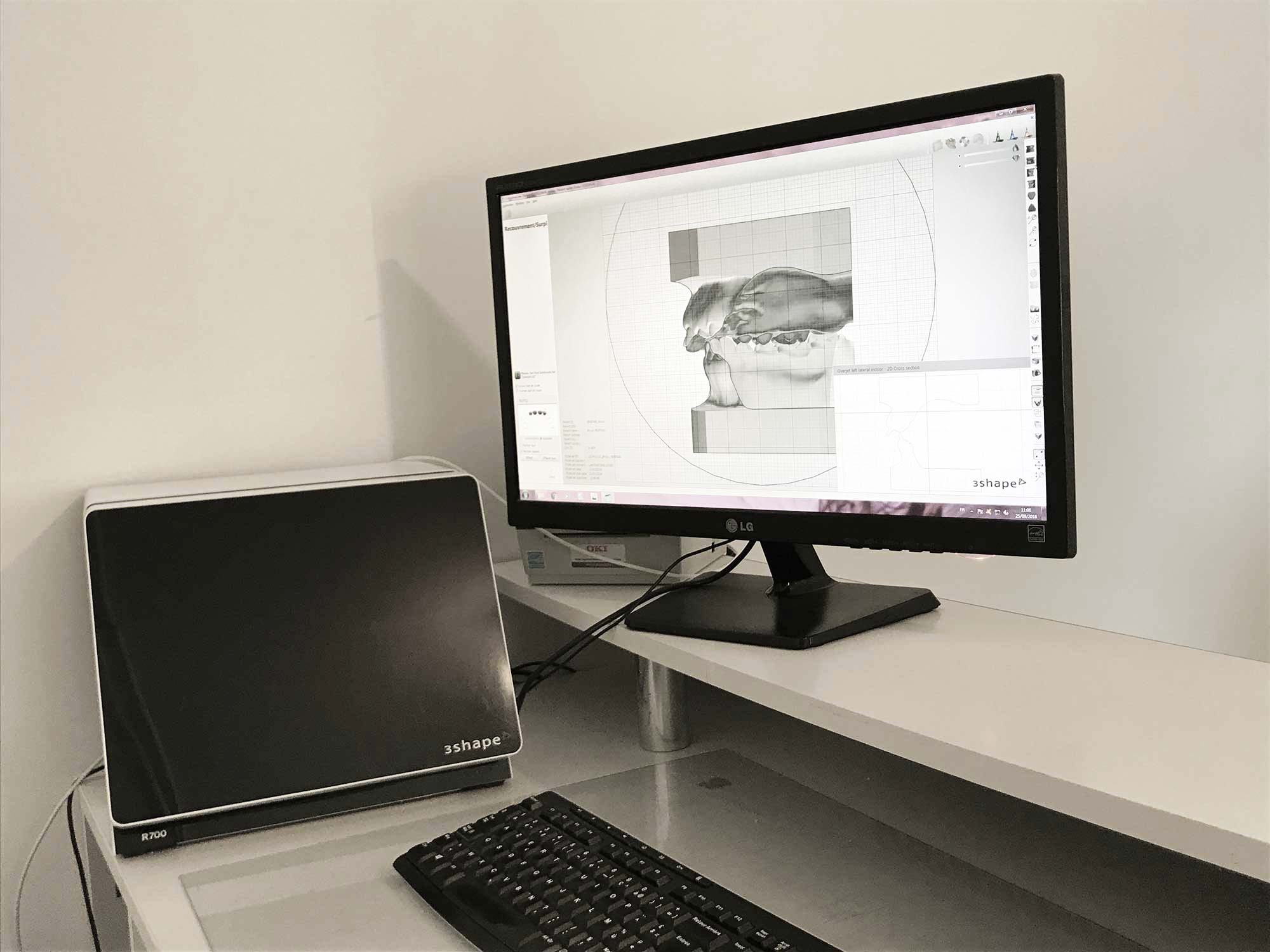 Analyse CFAO - Laboratoire Lionet