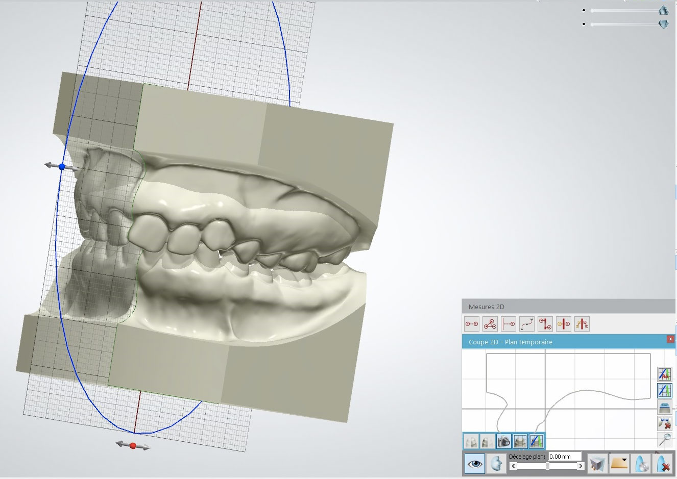 Modèle étude 3D - Laboraoitre Lionet