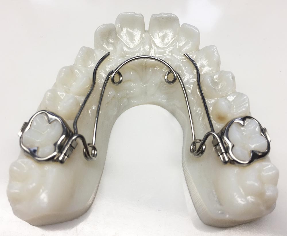 Quadhelix amovible - Laboratoire Lionet