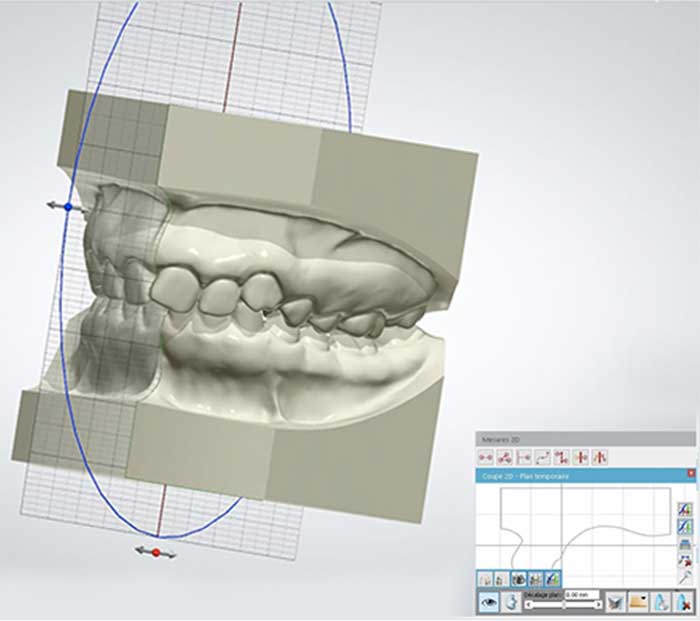 Modèle étude 3D - Laboraoitre Lionet