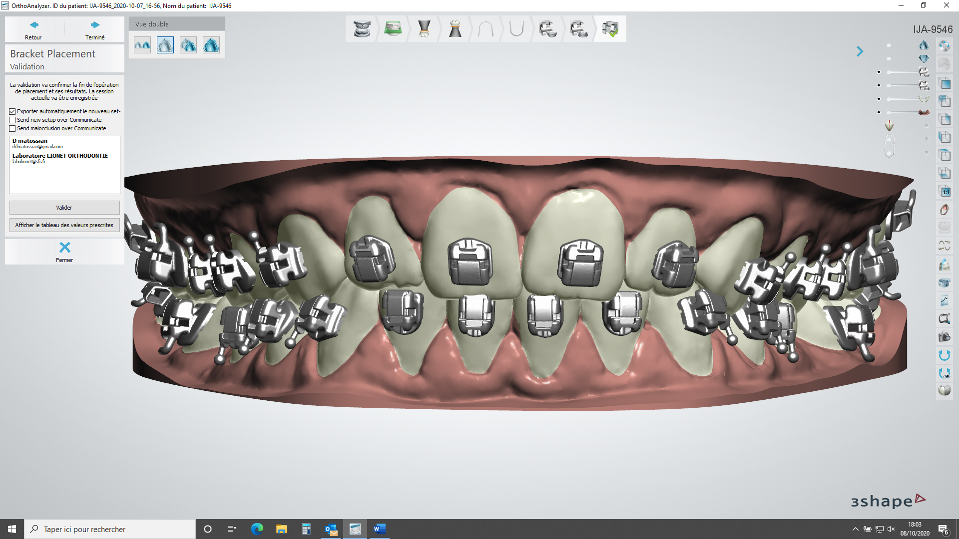 Modèle étude 3D - Laboraoitre Lionet